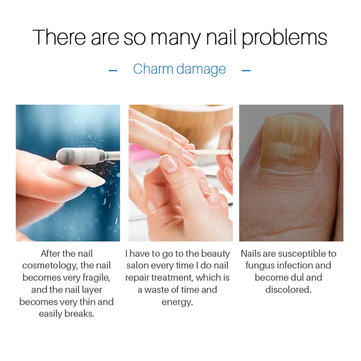 Nail Repair Essence Pen