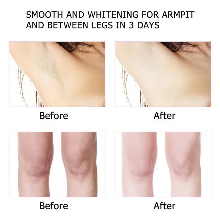 Whitening Body Cream - Dark Spot Corrector