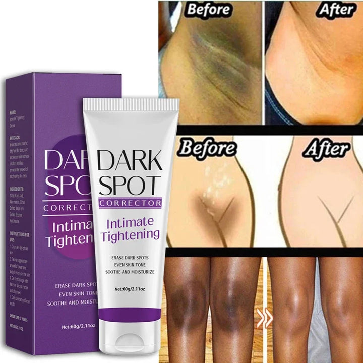 Whitening Body Cream - Dark Spot Corrector